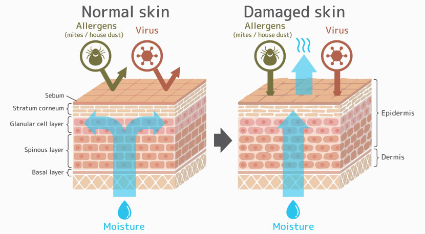 normal-damage_skin